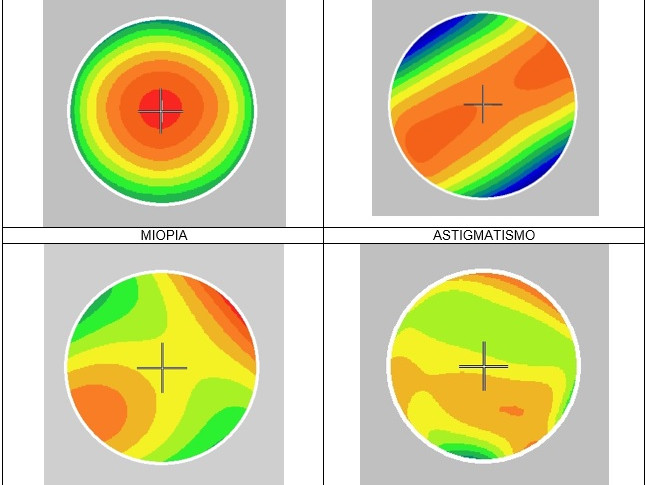 Analisi Visiva Aberrometrica